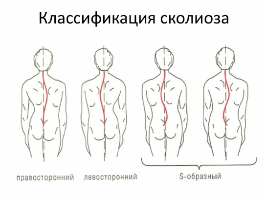 [KinesioPro]%20%D0%A1%D0%BA%D0%BE%D0%BB%D0%B8%D0%BE%D0%B7%20(%D0%94%D0%BC%D0%B8%D1%82%D1%80%D0%B8%D0%B9%20%D0%93%D0%BE%D1%80%D0%BA%D0%BE%D0%B2%D1%81%D0%BA%D0%B8%D0%B9).png